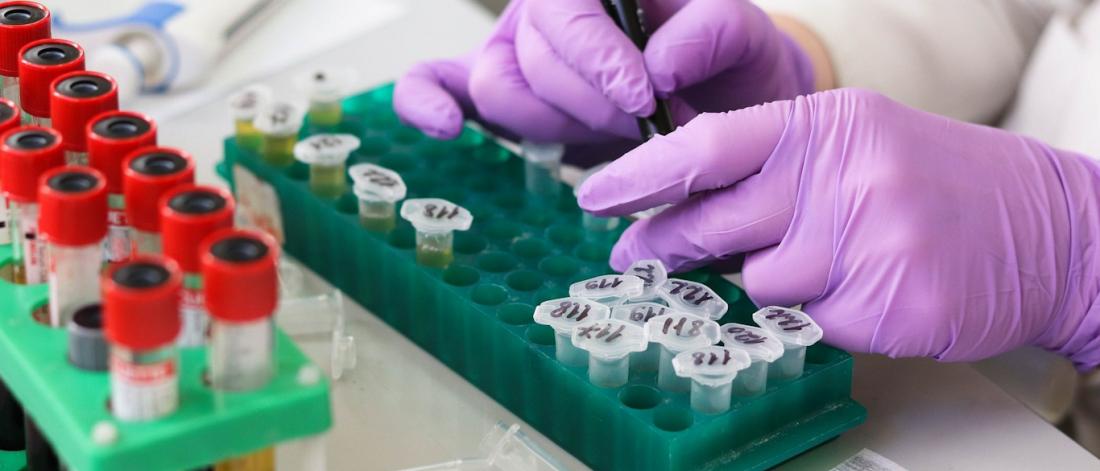 Researcher working with a test tube.